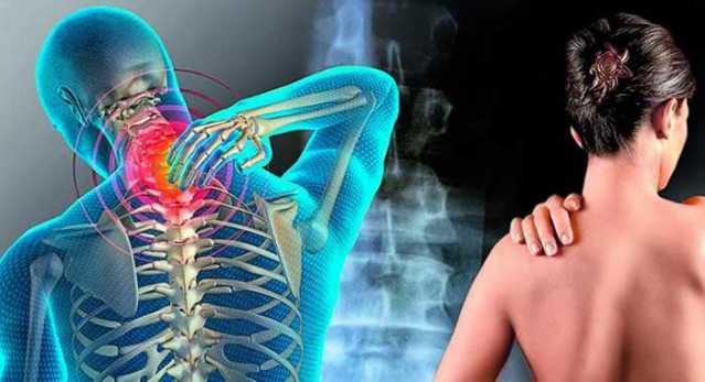Fibromialgia
