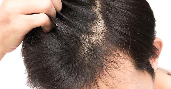 1537732877800.jpg  Calvizie  Il Metodo Infallibile Per Salvare I Capelli  Ecco Cosa Dovete Mangiare Ogni Giorno   Guarda