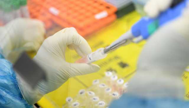 Virus Laboratorio