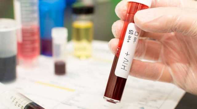Hiv Test