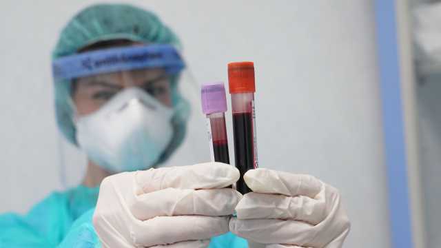 Coronavirus Primo Test