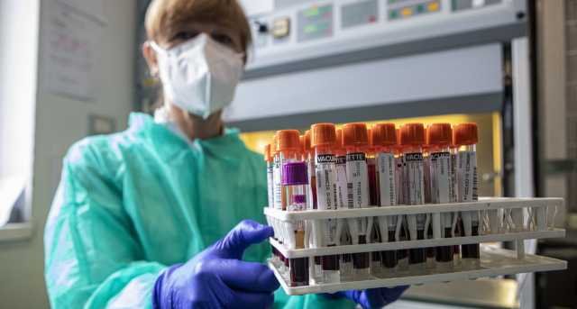 Tamponi Test Sier