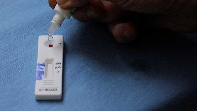 Coronavirus03ago1