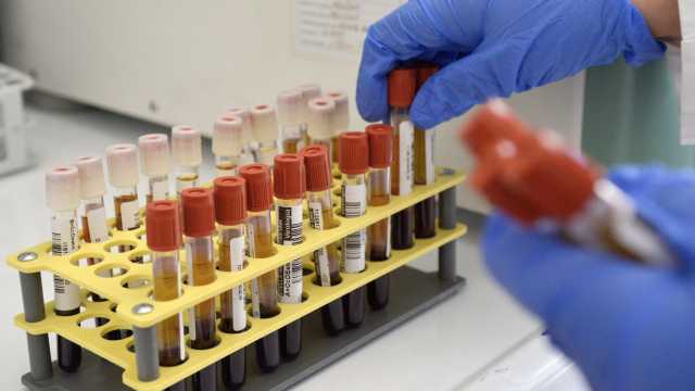Plasma Iperimmune
