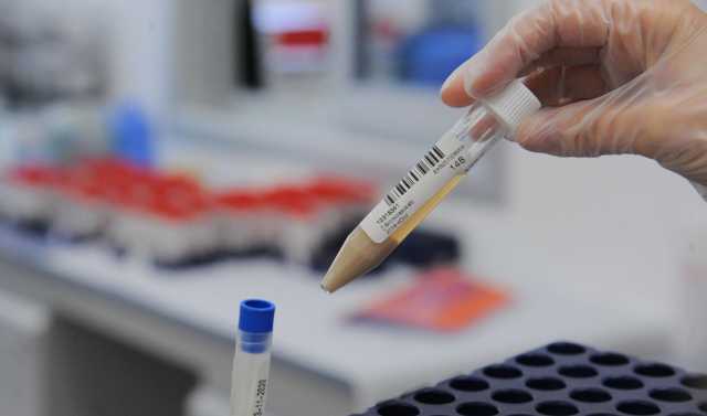 Laboratorio tamponi 