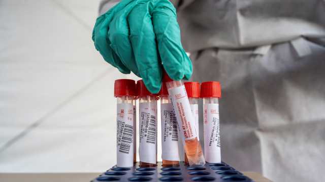 Ancora test contro il virus in Sardegna 