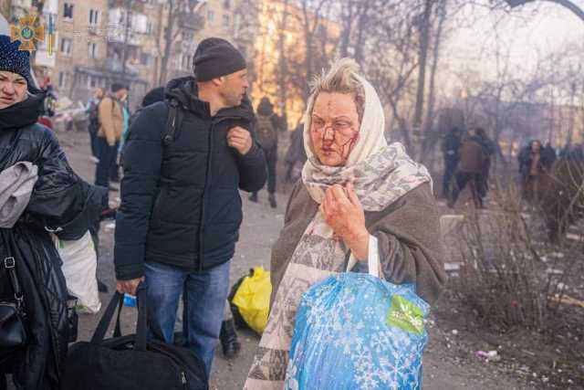 Ucraina donna bombardamenti