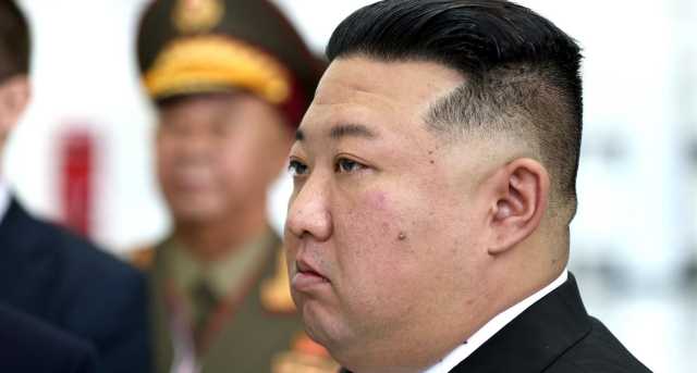 Kim Un