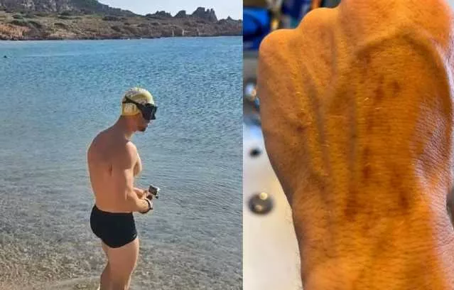 Il Turista Aggredito