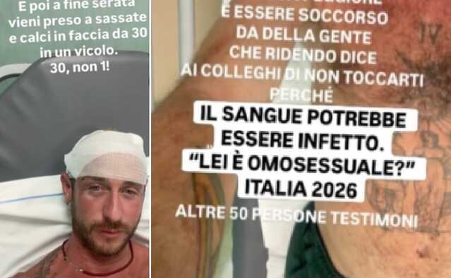Aggressione omofoba a Porto Istana, la storia è virale: "Calci e sassate", ferite anche ragazze