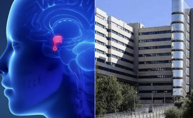 Tumori all'ipofisi, il Brotzu di Cagliari unico centro regionale di riferimento: c'è un nuovo percorso diagnostico