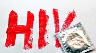 hIV