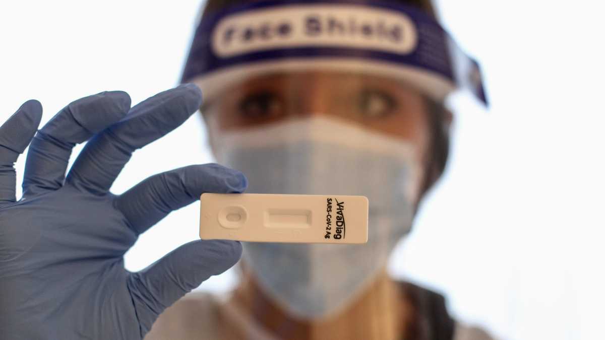 Test-antigenici
